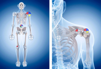 Rheumexpert subject of Master Thesis at the Medical University of Vienna, Austria